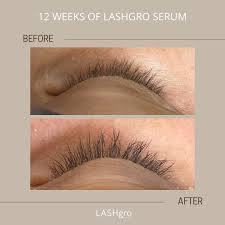 LASHGro Eyelash Growth Serum